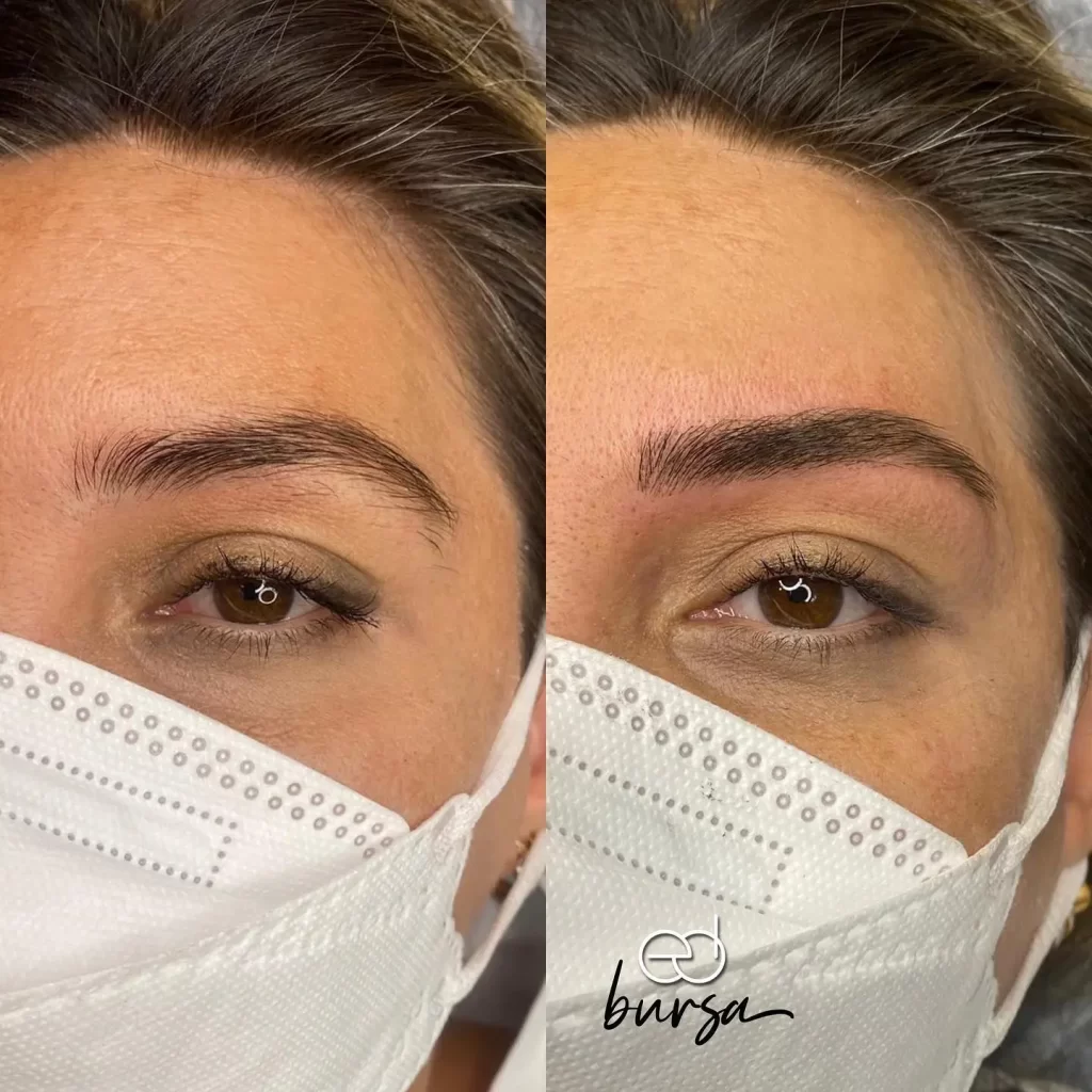 Emsal Doğan Bursa microblading öncesi sonrası 2