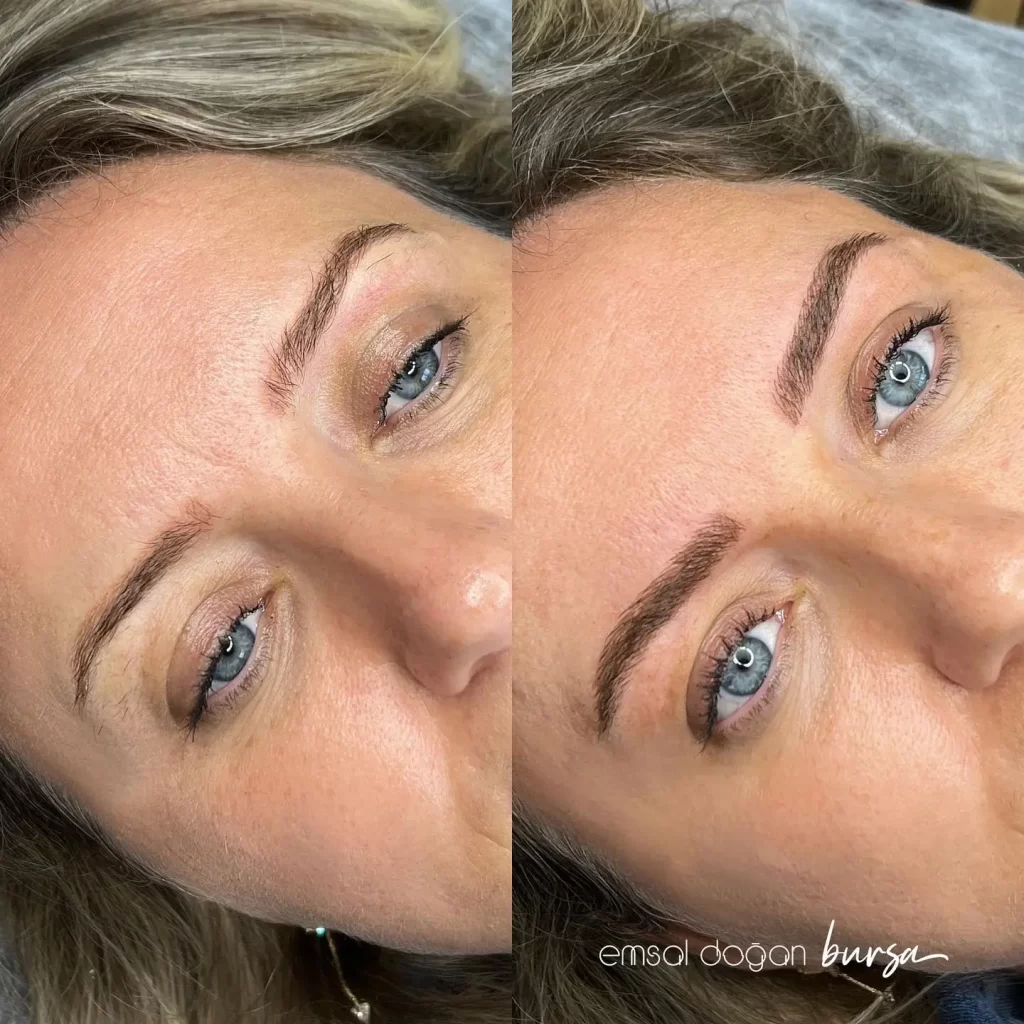 Emsal Doğan Bursa microblading öncesi sonrası 4