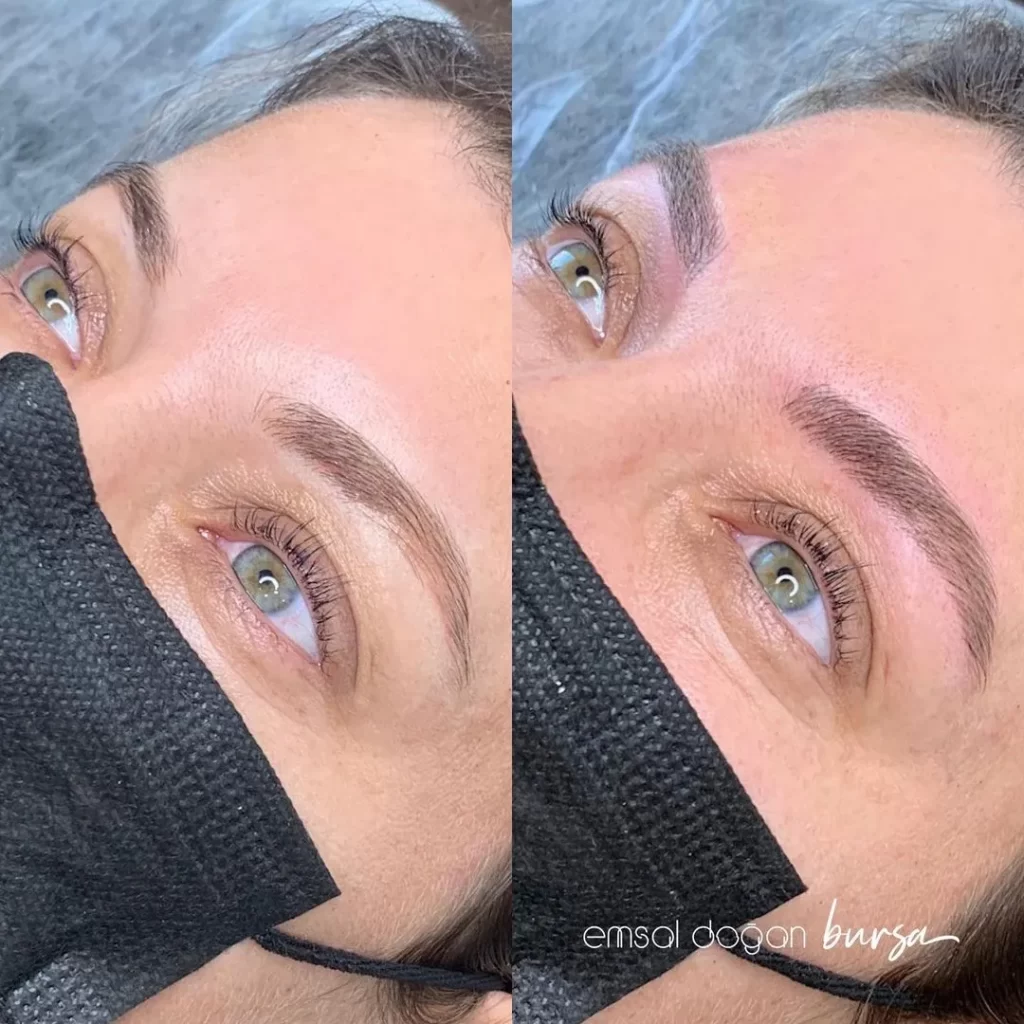 Emsal Doğan Bursa microblading öncesi sonrası 1