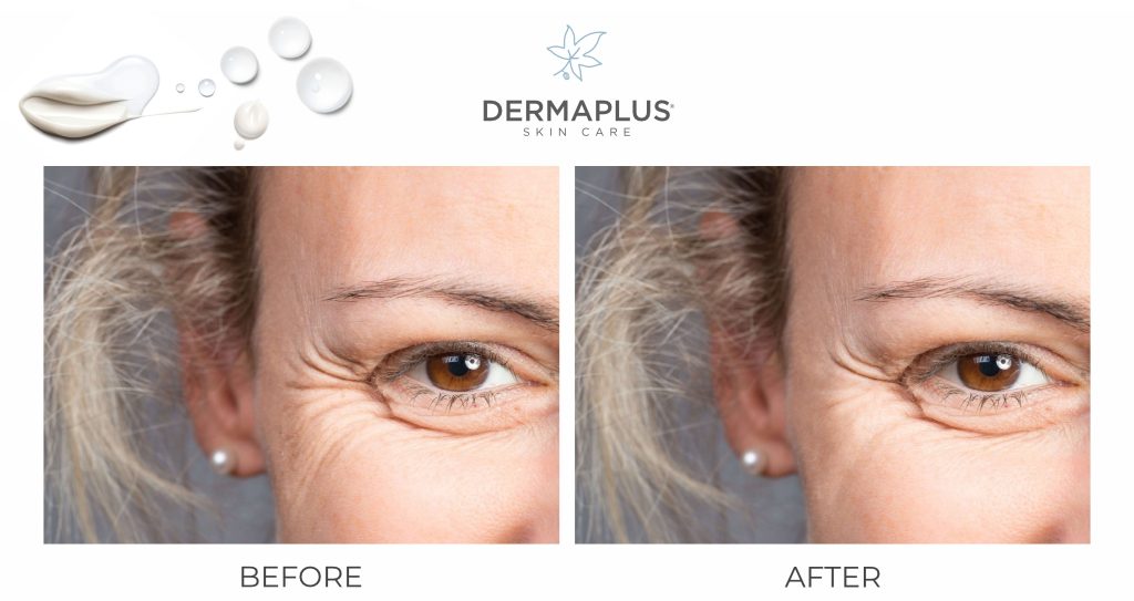 Anti-aging yaşlanma karşıtı cilt bakımı — Emsal Doğan Bursa